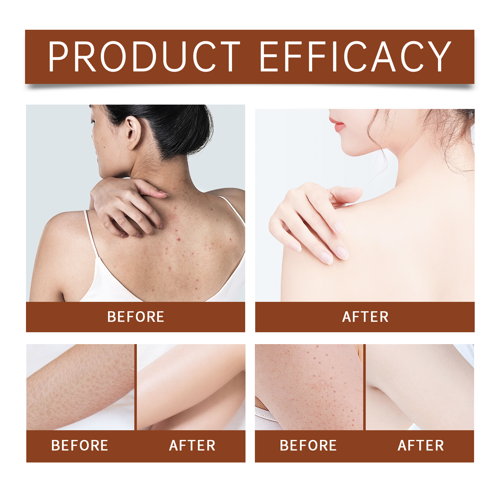 Luxury Body Oil for Dry Skin A - Luxury Skincare Moisturizer recensione e prezzo
